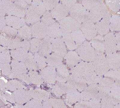 Immunohistochemistry-Paraffin: LAPTM5 Antibody [NBP2-14183]