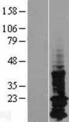 Western Blot: LAPTM5 Overexpression Lysate [NBP2-07587]