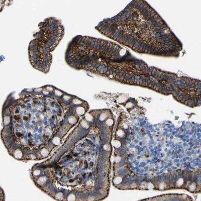 Immunohistochemistry-Paraffin: LAR/PTPRF Antibody [NBP1-81325]