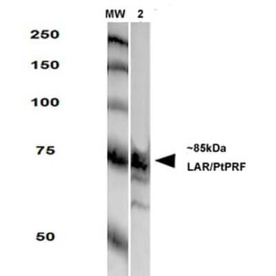 Western Blot: LAR/PTPRF Antibody (S165-38) [NBP2-42172]