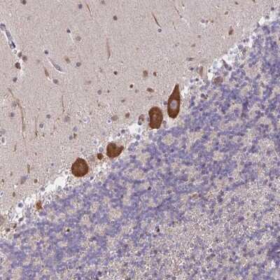 Immunohistochemistry: LARP1 Antibody [NBP2-49151]