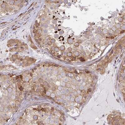 Immunohistochemistry-Paraffin: LARP1 Antibody [NBP2-49004]