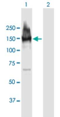 Western Blot: LARP1 Antibody [H00023367-B01P]