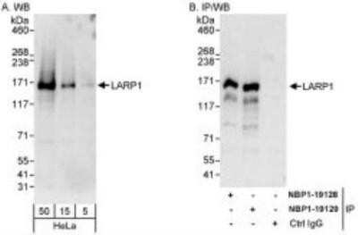 Western Blot: LARP1 Antibody [NBP1-19129]