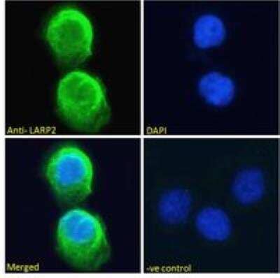 Immunocytochemistry/ Immunofluorescence: LARP2 Antibody [NB100-60945]