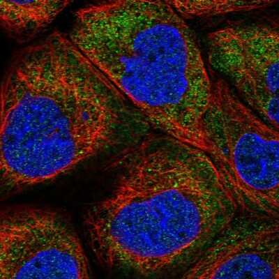 Immunocytochemistry/ Immunofluorescence: LARP2 Antibody [NBP1-84184]