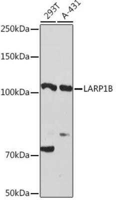 Western Blot: LARP2 AntibodyAzide and BSA Free [NBP3-03504]