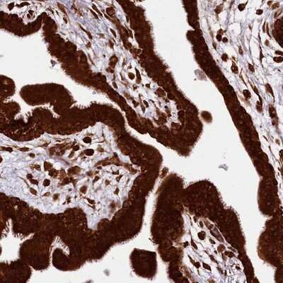 Immunohistochemistry-Paraffin: LARP4 Antibody [NBP1-80889]