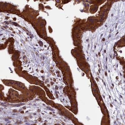 Immunohistochemistry-Paraffin: LARP4 Antibody [NBP1-80890]