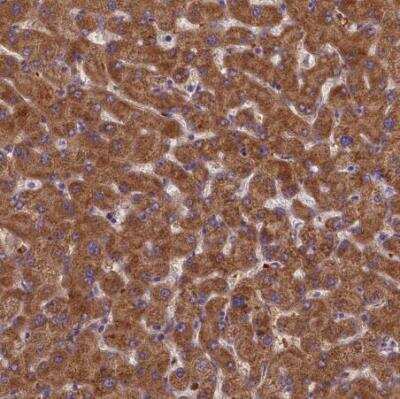 Immunohistochemistry-Paraffin: LARP4 Antibody [NBP1-80890]