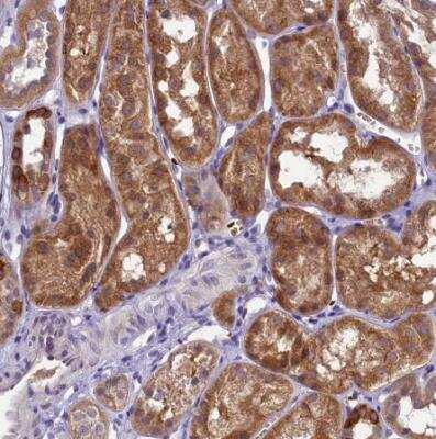 Immunohistochemistry-Paraffin: LARP4 Antibody [NBP1-80890]