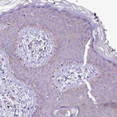 Immunohistochemistry-Paraffin: LARP4 Antibody [NBP1-80890]