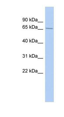 Western Blot: LARP4 Antibody [NBP1-80472]