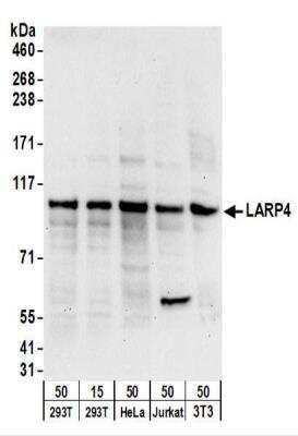 Western Blot: LARP4 Antibody [NBP2-22254]