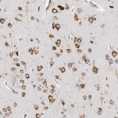 Immunohistochemistry-Paraffin: LARP5 Antibody [NBP1-87902]