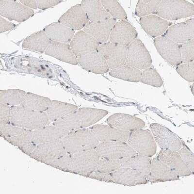 Immunohistochemistry-Paraffin: LARP5 Antibody [NBP1-87902]