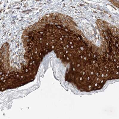 Immunohistochemistry-Paraffin: LARP5 Antibody [NBP1-87902]