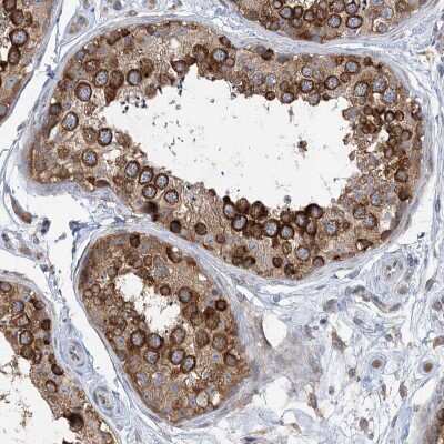 Immunohistochemistry-Paraffin: LARP5 Antibody [NBP1-87902]