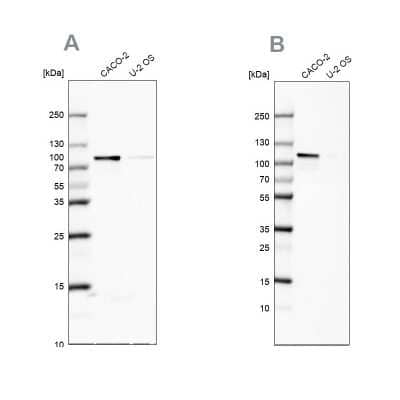 Western Blot: LARP5 Antibody [NBP1-87902]