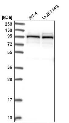 Western Blot: LARP5 Antibody [NBP2-55184]