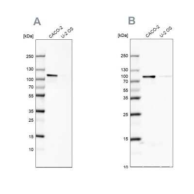 Western Blot: LARP5 Antibody [NBP2-55184]