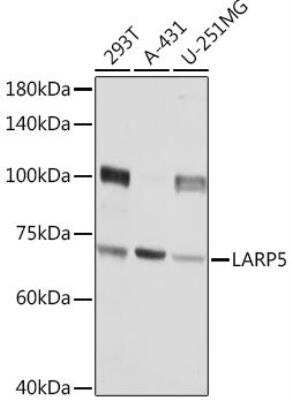 Western Blot: LARP5 AntibodyAzide and BSA Free [NBP3-05086]