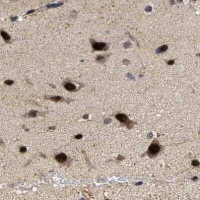 Immunohistochemistry-Paraffin: LARP6 Antibody [NBP1-89277]