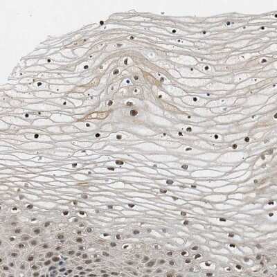 Immunohistochemistry-Paraffin: LARP6 Antibody [NBP1-89277]