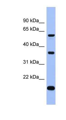 Western Blot: LARP6 Antibody [NBP1-57460]