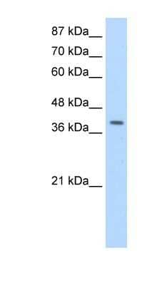 Western Blot: LARP7 Antibody [NBP1-57554]