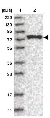 Western Blot: LARP7 Antibody [NBP1-85083]