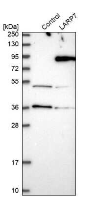 Western Blot: LARP7 Antibody [NBP1-85084]