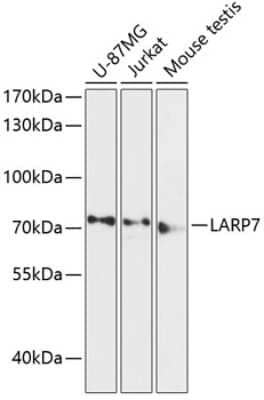 Western Blot: LARP7 AntibodyAzide and BSA Free [NBP3-04755]