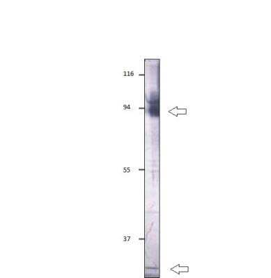 Western Blot: LARP7 Antibody [NBP3-12439]