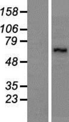 Western Blot: LARP7 Overexpression Lysate [NBP2-07172]