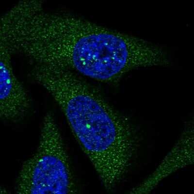 Immunocytochemistry/ Immunofluorescence: LARS Antibody [NBP1-90430]