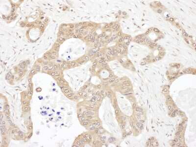 Immunohistochemistry-Paraffin: LARS Antibody [NBP2-32209]