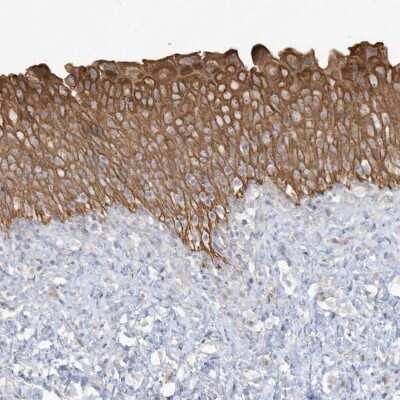 Immunohistochemistry-Paraffin: LARS Antibody [NBP1-90430]