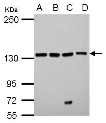 Western Blot: LARS Antibody [NBP2-19333]