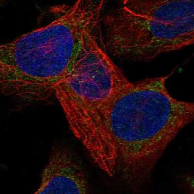 Immunocytochemistry/ Immunofluorescence: LARS2 Antibody [NBP2-57749]