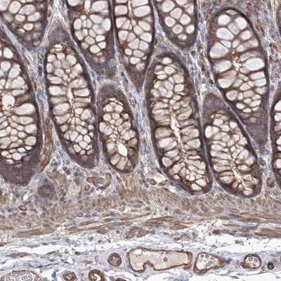 Immunohistochemistry-Paraffin: LARS2 Antibody [NBP1-83059]