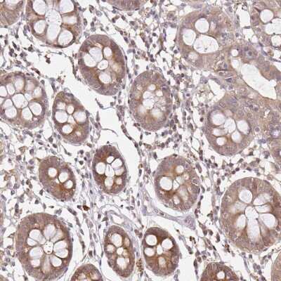 Immunohistochemistry-Paraffin: LARS2 Antibody [NBP2-48830]