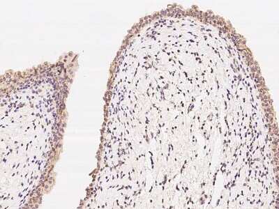 Immunohistochemistry-Paraffin: LARS2 Antibody [NBP2-97497]