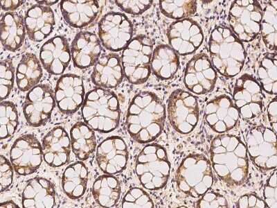 Immunohistochemistry-Paraffin: LARS2 Antibody [NBP2-97497]