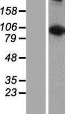 Western Blot: LARS2 Overexpression Lysate [NBP2-07186]