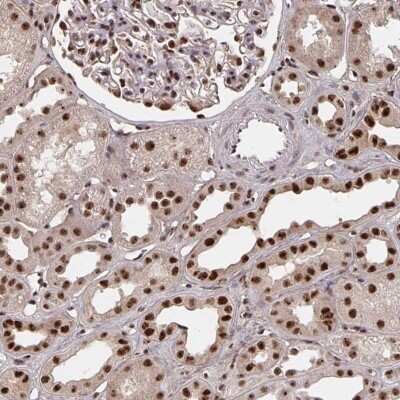 Immunohistochemistry: LAS1L Antibody [NBP2-38921]