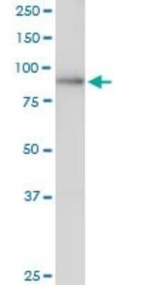 Western Blot: LAS1L Antibody [H00081887-B01P]