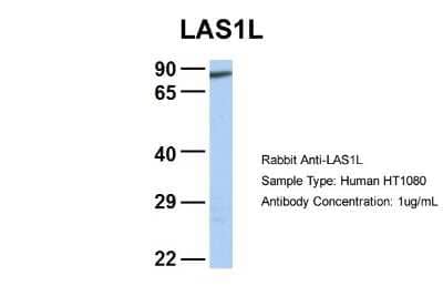 Western Blot: LAS1L Antibody [NBP2-85202]