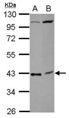 Western Blot: LAS2 Antibody [NBP2-15638]