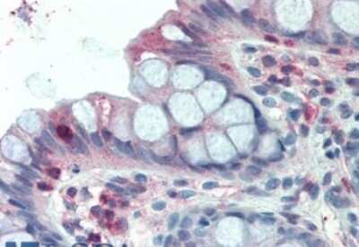 Immunohistochemistry-Paraffin: LASP1 Antibody [NB100-77338]